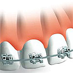 fogszab&aacute;lyoz&aacute;s - dentaurum