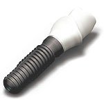 wi.tal implant&aacute;tum